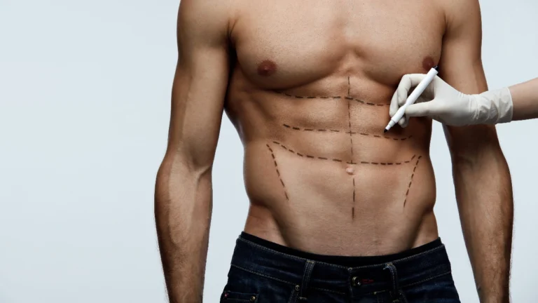 ไม่มีซิกแพคไม่ใช่ไม่ฟิต แต่ไขมันเกินก็ไม่ควรมองข้าม